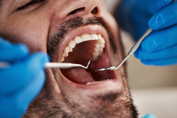 Best Emergency Dental Care for Trauma or Injury in Rosenhayn, NJ